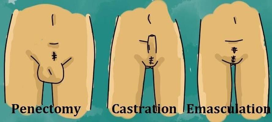 Castración, Penectomía